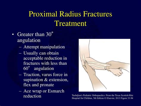 Fractures And Dislocations About The Elbow In The Pediatric Patient