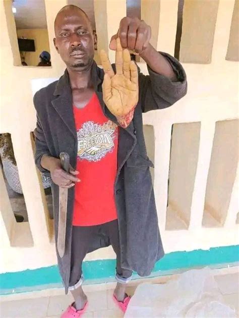 Man Allegedly Chops Off His Wifes Hand Over N3000 In Jos