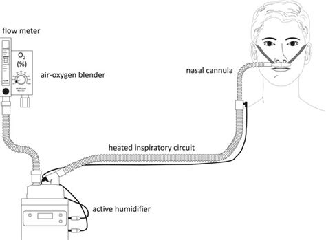 Salter High Flow Nasal Cannula Fio2 - Blog - Doctor B (the PT) : Wirtz, effectiveness of nasal ...