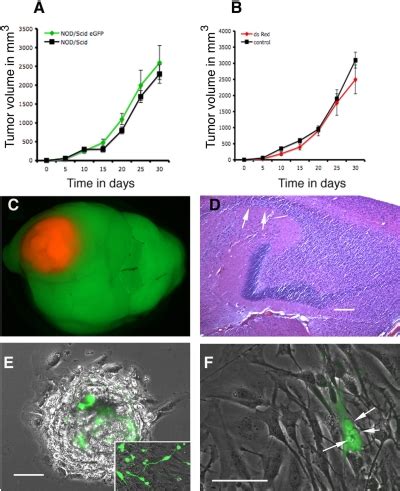 A U Subcutaneous Tumor Growth In Nod Scid Egfp And In Nod Scid Mice