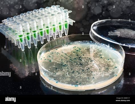 Bacterial Colonies For Cloning Of Transgenic Vector Into Plasmid Dna