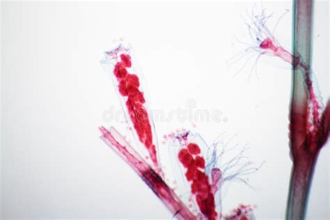 Obelia Hydroid Stock Image Image Of Microscope Hydrozoa 119628405