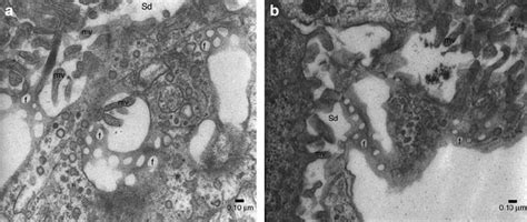 Representative Transmission Electron Micrographs Showing Murine A