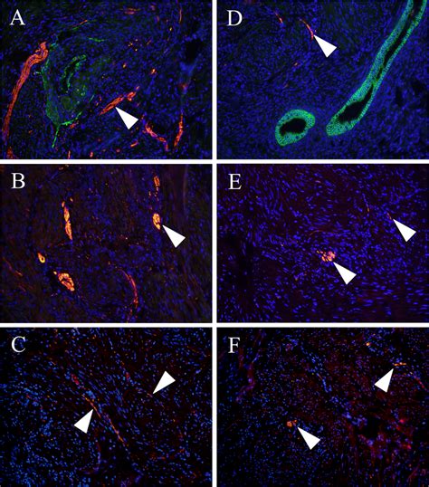 Immunofluorescence Histochemical Staining Of The Total Nerve Fiber And