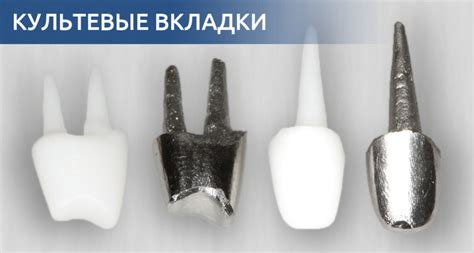 От чего зависит цена на культевую вкладку под коронку | Блог ...