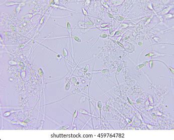 5,326 Sperm Microscope Images, Stock Photos, 3D objects, & Vectors ...