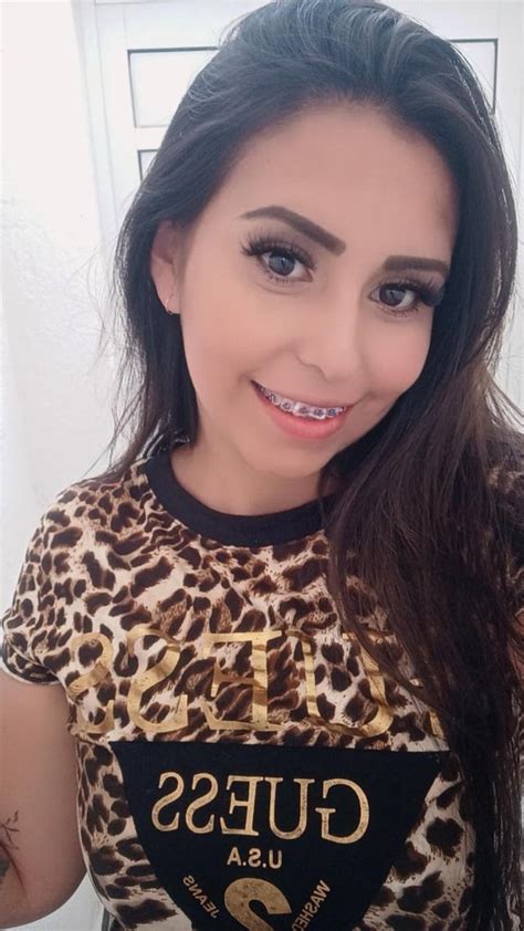 Hows Your Day Going Guys🥰 R Amature Braces