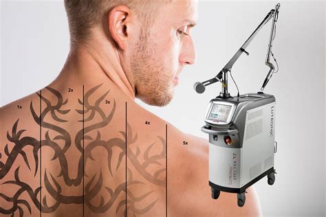 Eliminaci N De Tatuajes En Skin Center Skincenter Clinica