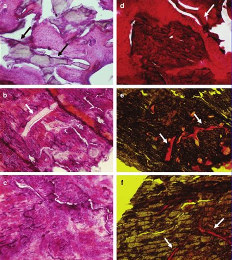 Histological Evaluation Of Tissue Reaction At Different Time Points Download Scientific Diagram