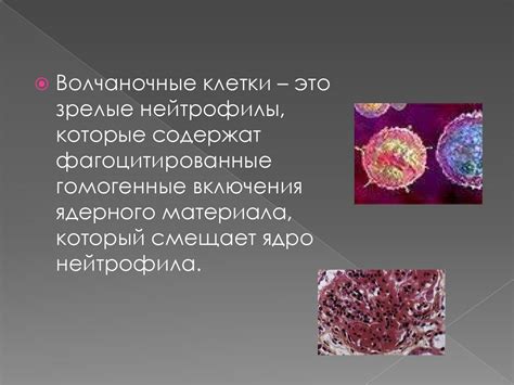 Системная красная волчанка СКВ презентация онлайн