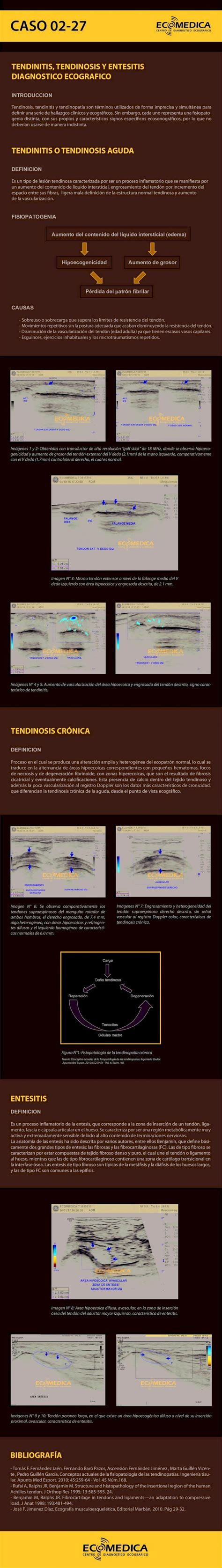 PDF DEFINICION FISIOPATOGENIA Aumento del contenido del líquido