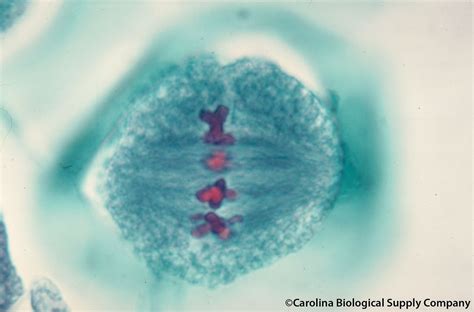 Metaphase Microscope