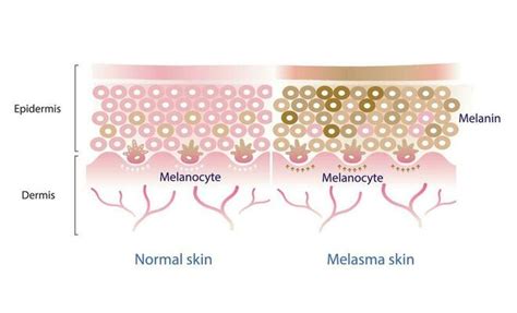Melanin Vector Art, Icons, and Graphics for Free Download
