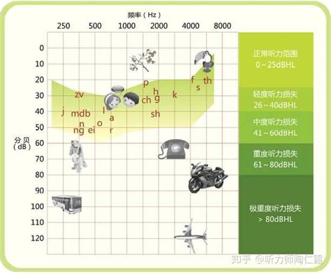 如何看懂“听力图”？ 知乎