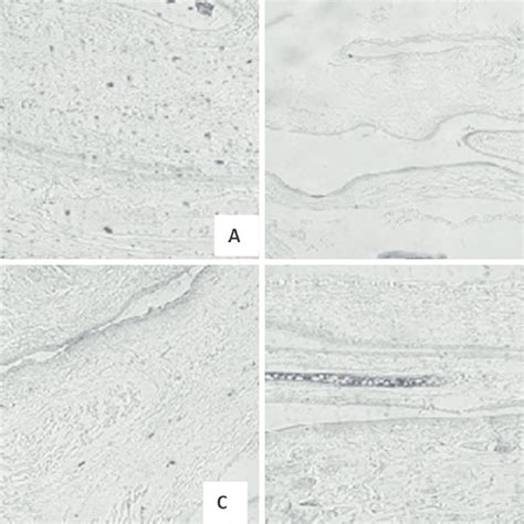 Light Photomicrographs Of The Retina Of Groups A B C And D Rats Download Scientific Diagram