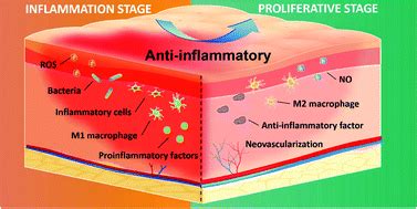 Anti-inflammation biomaterial platforms for chronic wound healing ...