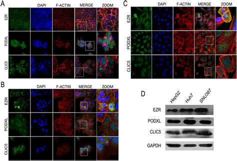 Expression And Localization Of Ezr Podxl And Clic In Hcc Cell Lines