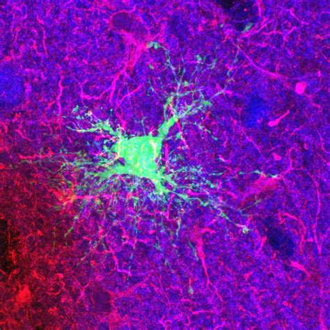 Cell Image Library — Astrocytes! - Image of the Week - July 13, 2015...