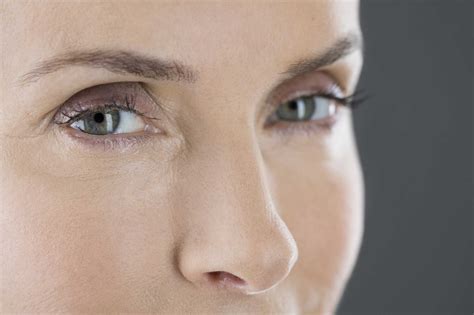 It's All in the Eyes - Botox
