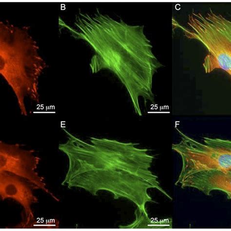 Focal adhesion formation and actin cytoskeleton in wild-type and FAK 2 ... 