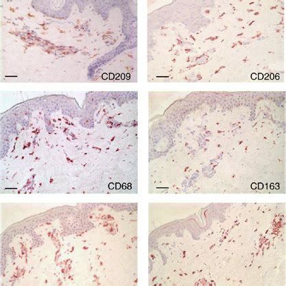 Morphology and distribution of monocyte/macrophage cell markers in ...