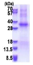 Recombinant Human TSSK6 Protein BSA And Azide Free Denatured Ab180300