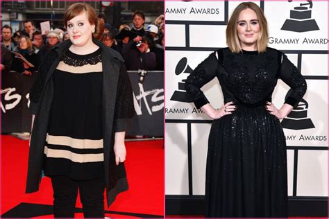 Adele’s Before and After Surgery Photos Show Proof of the Singer’s Transformation – Back Beat Funds