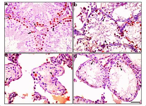 Light Microscopy Of Testicular Tissue In Different Groups A In