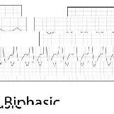 Screen shot of the VasoPad volume plethysmography types. The volume... | Download Scientific Diagram