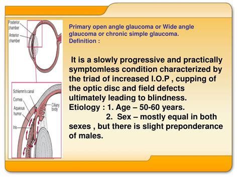 Ppt Glaucoma Powerpoint Presentation Free Download Id3096922