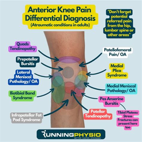 Neuro Ortho Knee Flashcards Quizlet