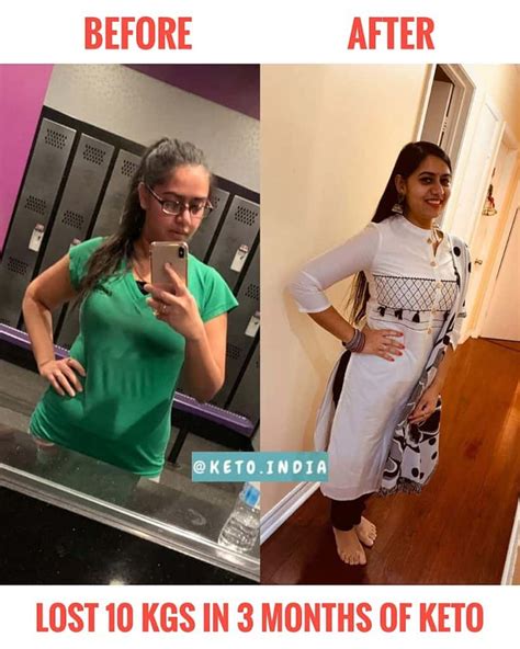 Keto Diet Weight Loss Transformation Story Of Ritika Keto Diet Plans