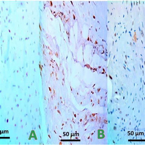 Representative Photographs Of Caspase Immunostaining Of Rat Left