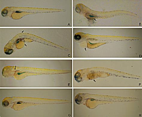 The Induction Of Lps On Inflammation Phenotype In Zebrafish The Yolks