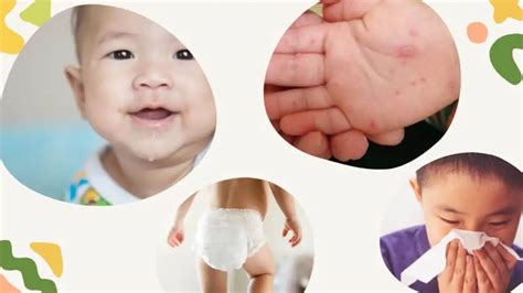 HFMD Explained: All you need to know to protect your little one - FirstStep Child Specialist Clinic