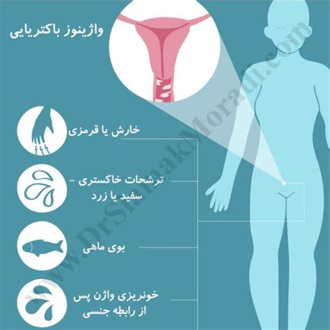 درد واژن و اندام تناسلی زنان، علایم، علت ها و درمان آن دکتر سیامک مرادی، فوق تخصص درد