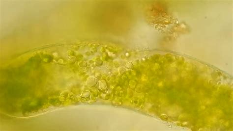 Live Green Algae Under Microscope, Magnification 400x Stock Footage ...