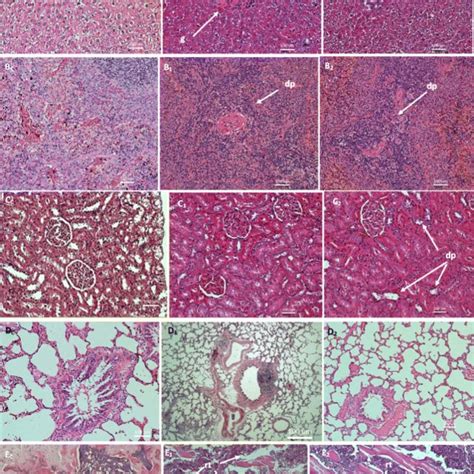 Micrographs Of The Normal And Pathological Liver A Spleen B Download Scientific Diagram