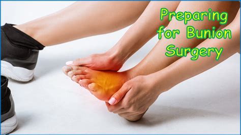 Your Comprehensive Guide To Preparing For Bunion Surgery