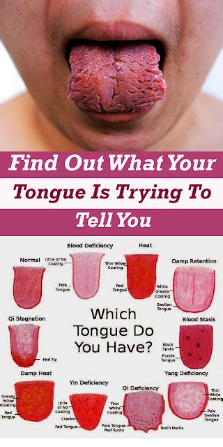 What Is Your Tongue Telling You About Your Health? | Healthy Wellness 101