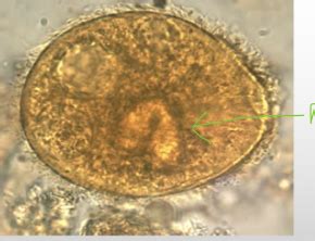 Exam Protists Nematodes Trematodes Cestodes Flashcards Quizlet