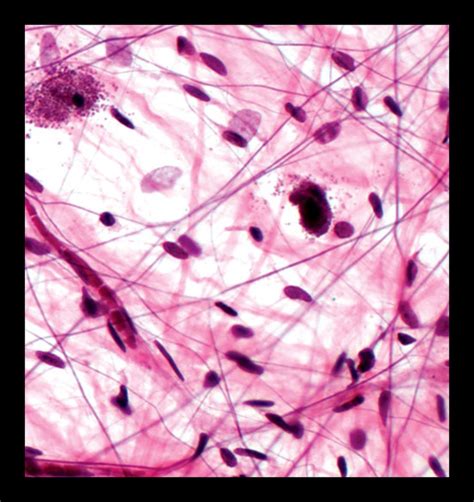 Areolar Connective Tissue Histology Slides Science Notes Microbiology