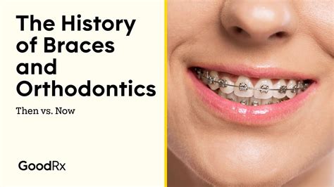 Braces The History Of Orthodontics Then Vs Now Goodrx Youtube