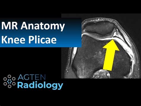 Knee Anatomy Plica