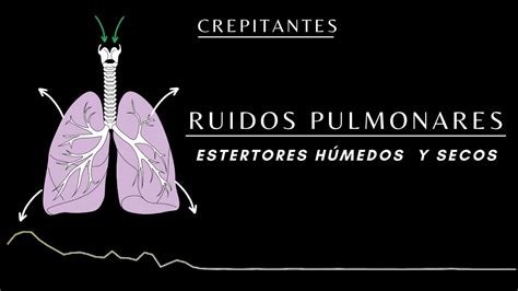 AuscultaciÓn Pulmonar Ruidos Pulmonares Normales Y Anormales