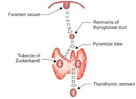 Development of embryological remnants of thyroid gland | Download ...