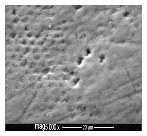 FE SEM Images Of Premolar Buccal Enamel Surfaces Etched With TSEP And