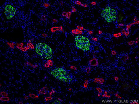 Calbindin-D28k antibody (66394-1-Ig) | Proteintech