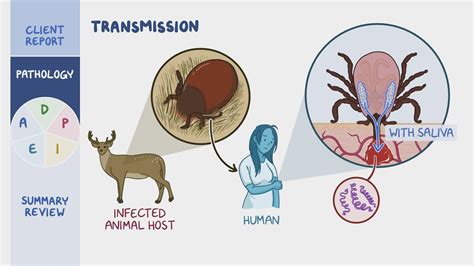 Lyme Disease Contagious Between Humans At Joan Byrd Blog