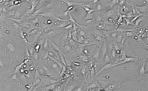 Lx Cas Human Hepatic Stellate Cell Line Scc